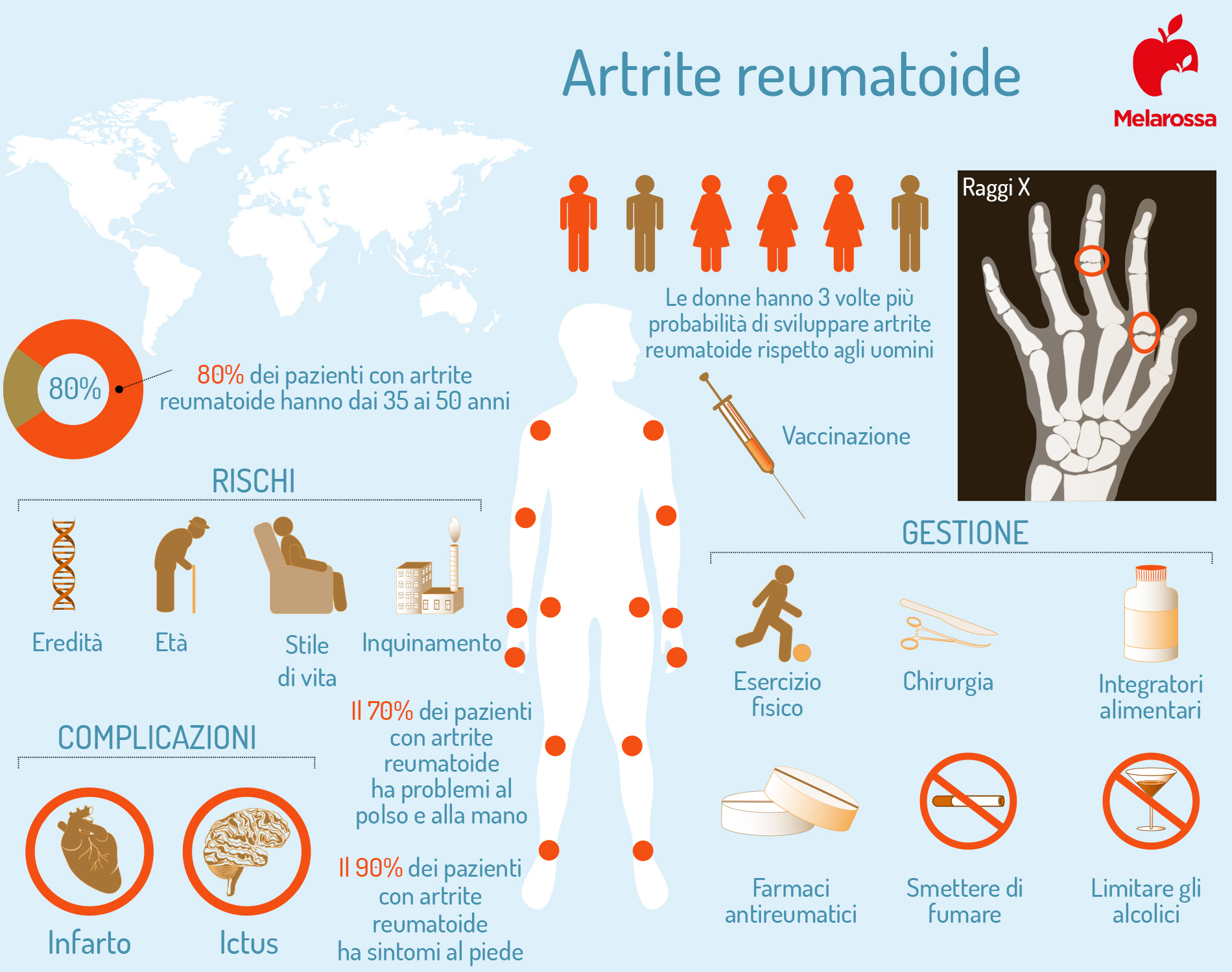 Artrite reumatoide: cos'è, sintomi e come si cura 1 artrite reumatoide: infografica