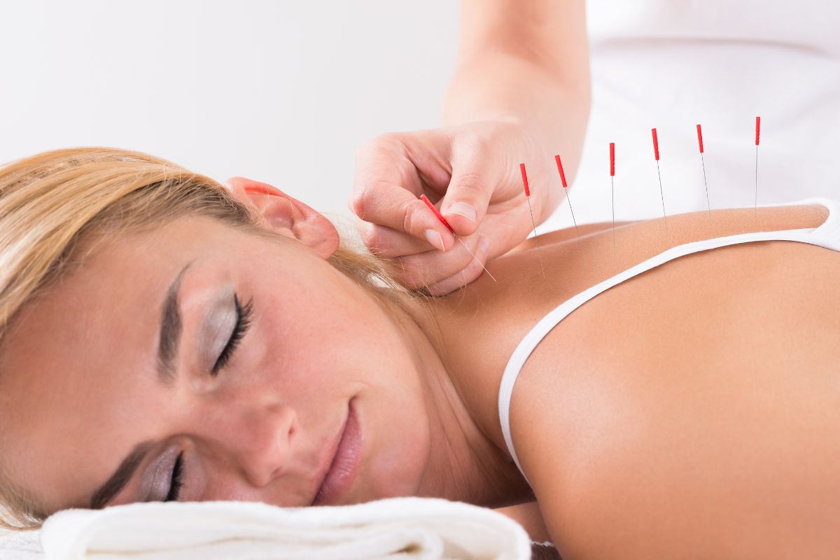 Fibromialgia: cos’è, cause, sintomi e cure 7 Fibromialgia e agopuntura
