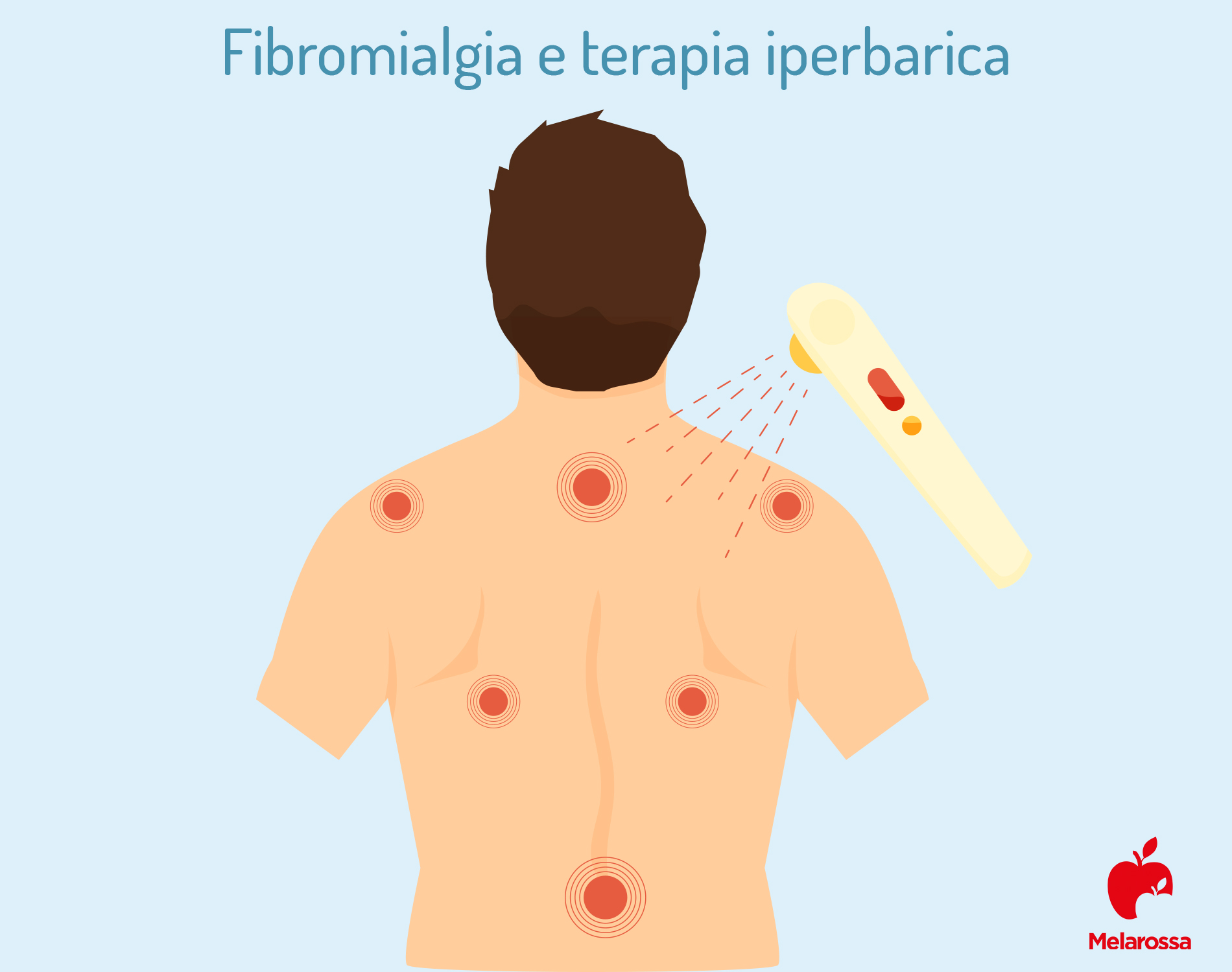 Fibromialgia: cos’è, cause, sintomi e cure 8 fibromialgia e terapia iperbarica