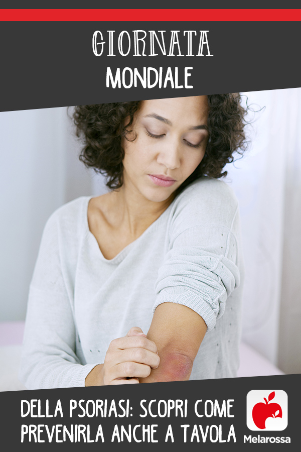 Giornata mondiale della psoriasi: scopri come prevenirla anche a tavola 2 giornata psoriasi 1