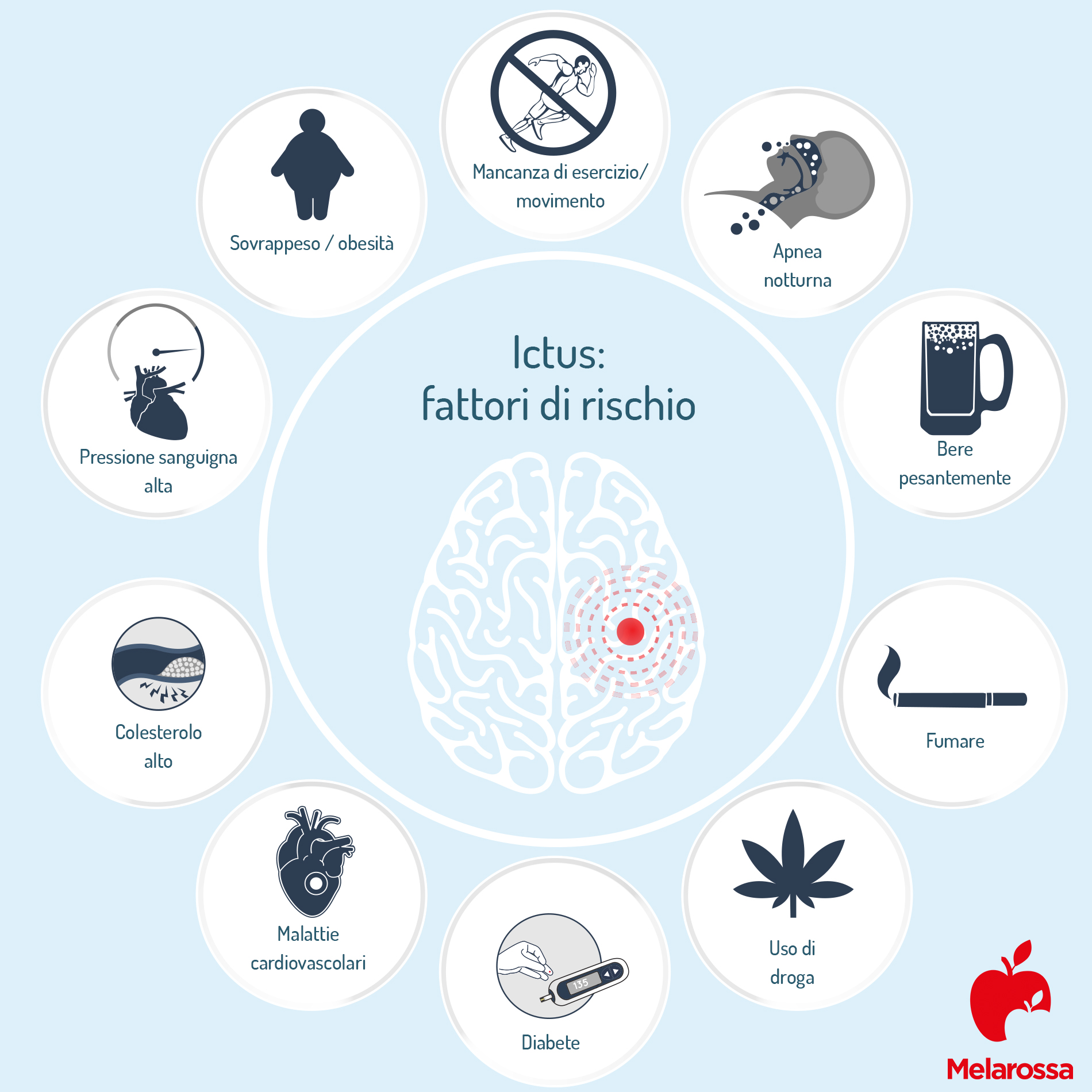 Ictus: cos'è, chi è a rischio, tipi, cause, sintomi, fattori di rischio, cure e prevenzione 4 Ictus: fattori