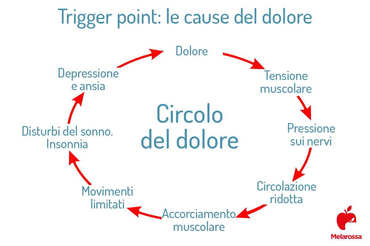 Trigger point: cosa sono, caratteristiche, tipi, sintomi, cure e quando è importante trattarli 2 Trigger point: circolo del dolore