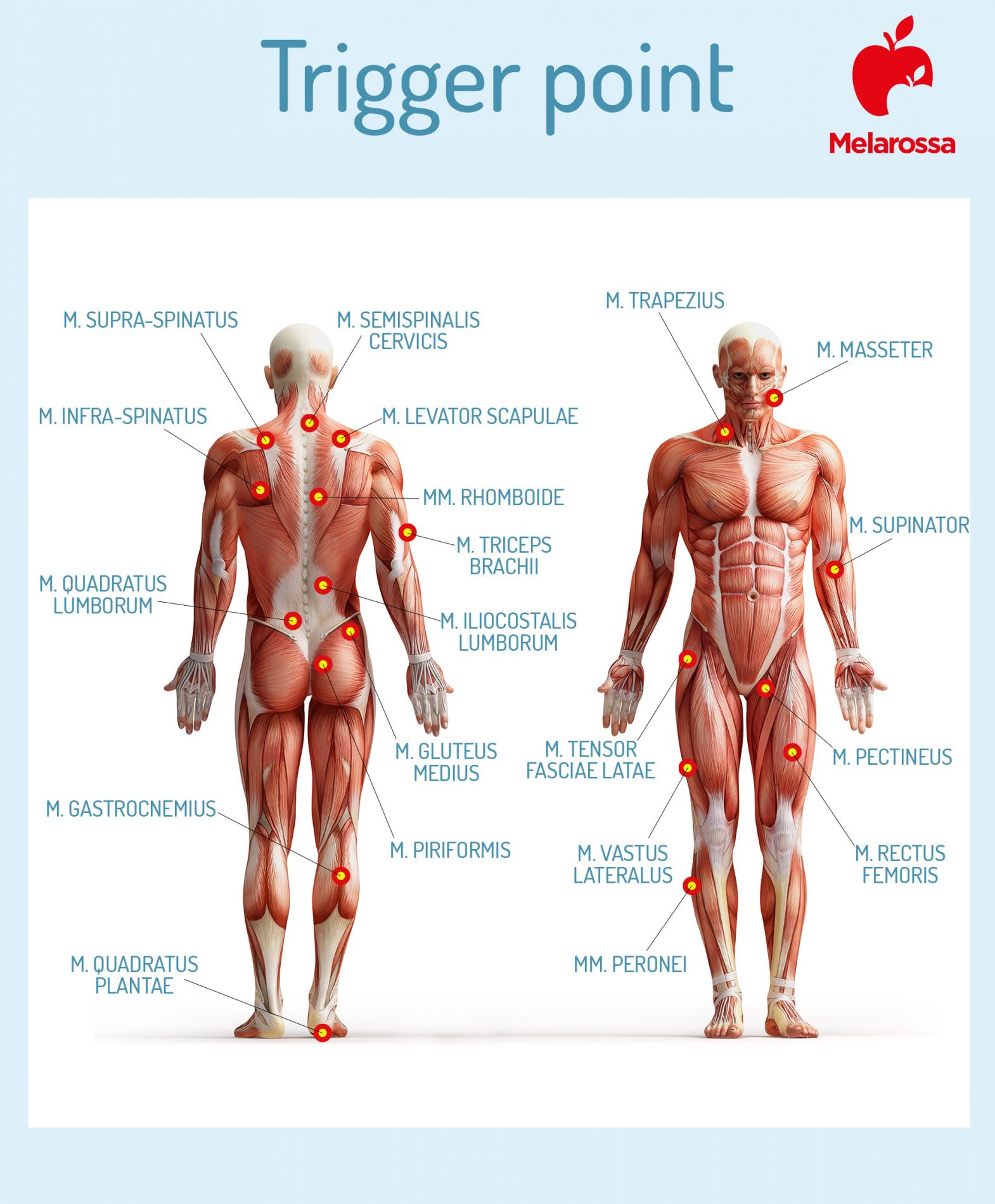 Trigger point: cosa sono, caratteristiche, tipi, sintomi, cure e quando è importante trattarli 1 Trigger point caratteristiche