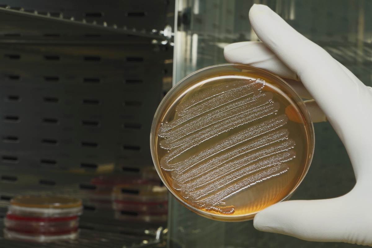 Argento colloidale: che cos’è, tipologie, proprietà, benefici, usi e controindicazioni 10 argento colloidale: microbiologia