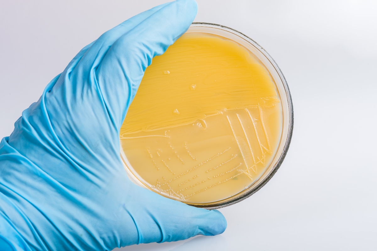Faringite: che cos'è, sintomi, cause, diagnosi e rimedi del mal di gola 5 diagnostica: faringite