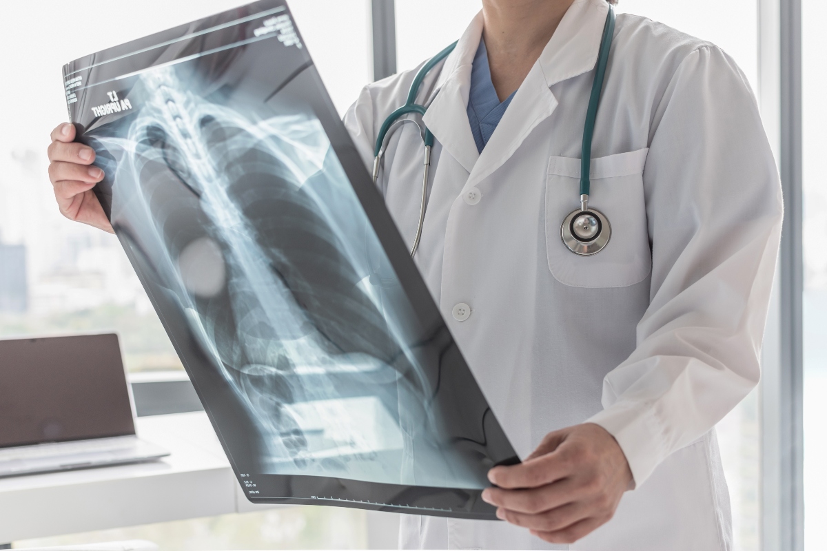 Enfisema polmonare: cos'è, cause, sintomi e cure 9 enfisema polmonare: diagnosi