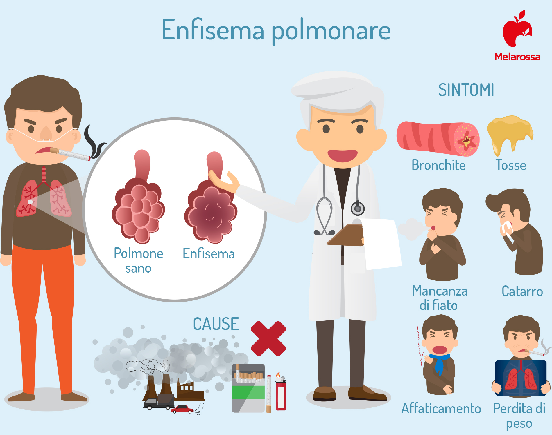 Enfisema polmonare: cos'è, cause, sintomi e cure 7 enfisema polmonare: sintomi