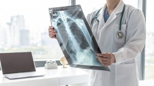 Fibrosi polmonare: cos&rsquo;&egrave;, chi colpisce, cause, sintomi, cure, complicazioni e prevenzione
