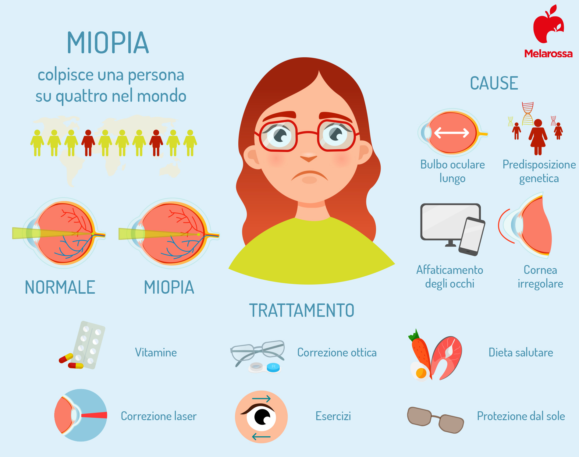 Miopia: cos’è, classificazione, cause, sintomi e cure 4 miopia: cause e trattamenti