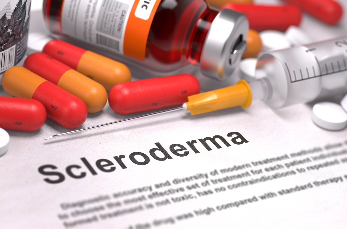 Sclerodermia: cos’è, cause, sintomi, tipi, cure e prevenzione 7 sclerodermia: cure