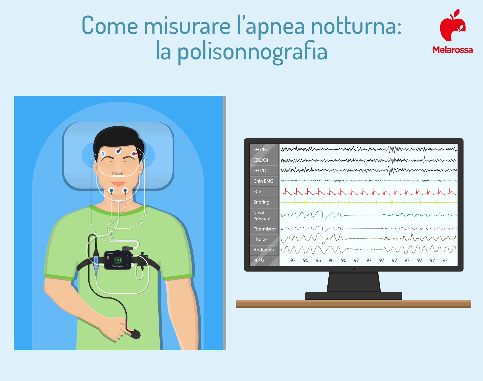 Apnea notturna: cos'è, cause, sintomi, conseguenze, cure e trattamenti 5 apnea notturna: polisonnografia