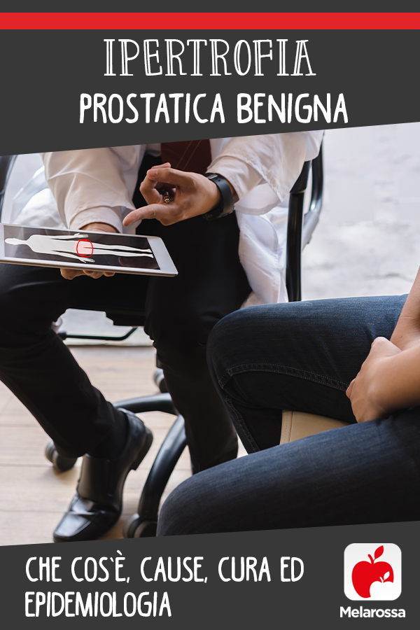 Ipertrofia prostatica benigna: che cos’è, cause, cura ed epidemiologia 7 ipertrofia prostatica: cos' è, cause, sintomi, cure e prevenzione