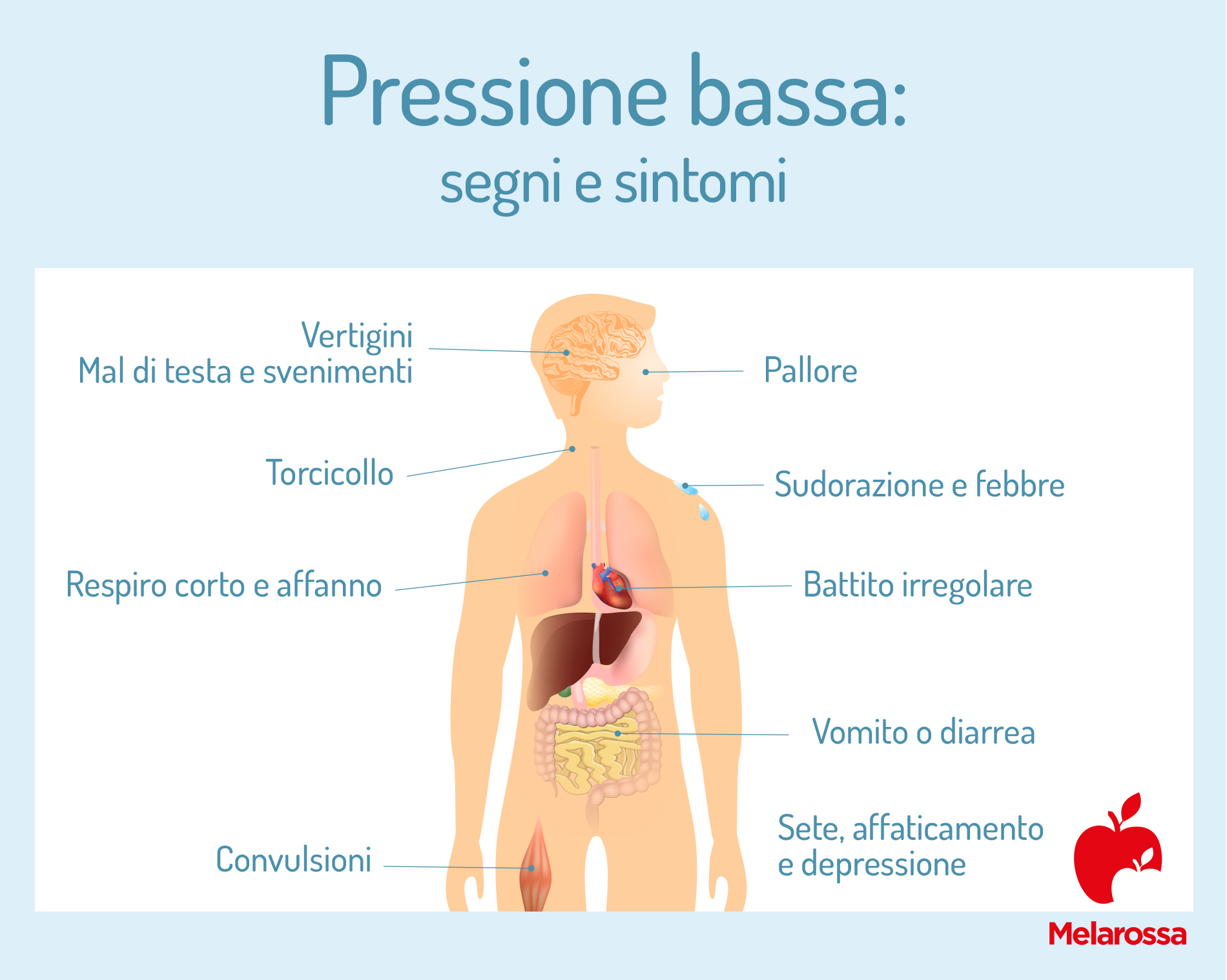 Pressione bassa: sintomi, rimedi, cause e cosa fare 1 una grafica con i sintomi da pressione bassa