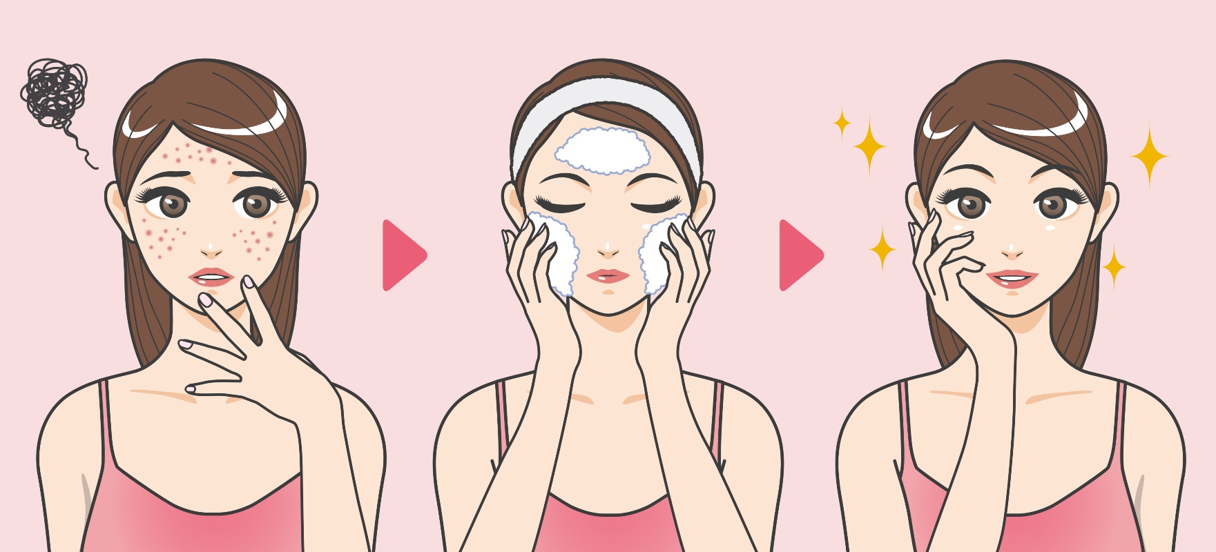 Acne: cos'è, perché compare, classificazione, cause, cura, rimedi e trattamenti 9 acne: cure e pulizia del viso