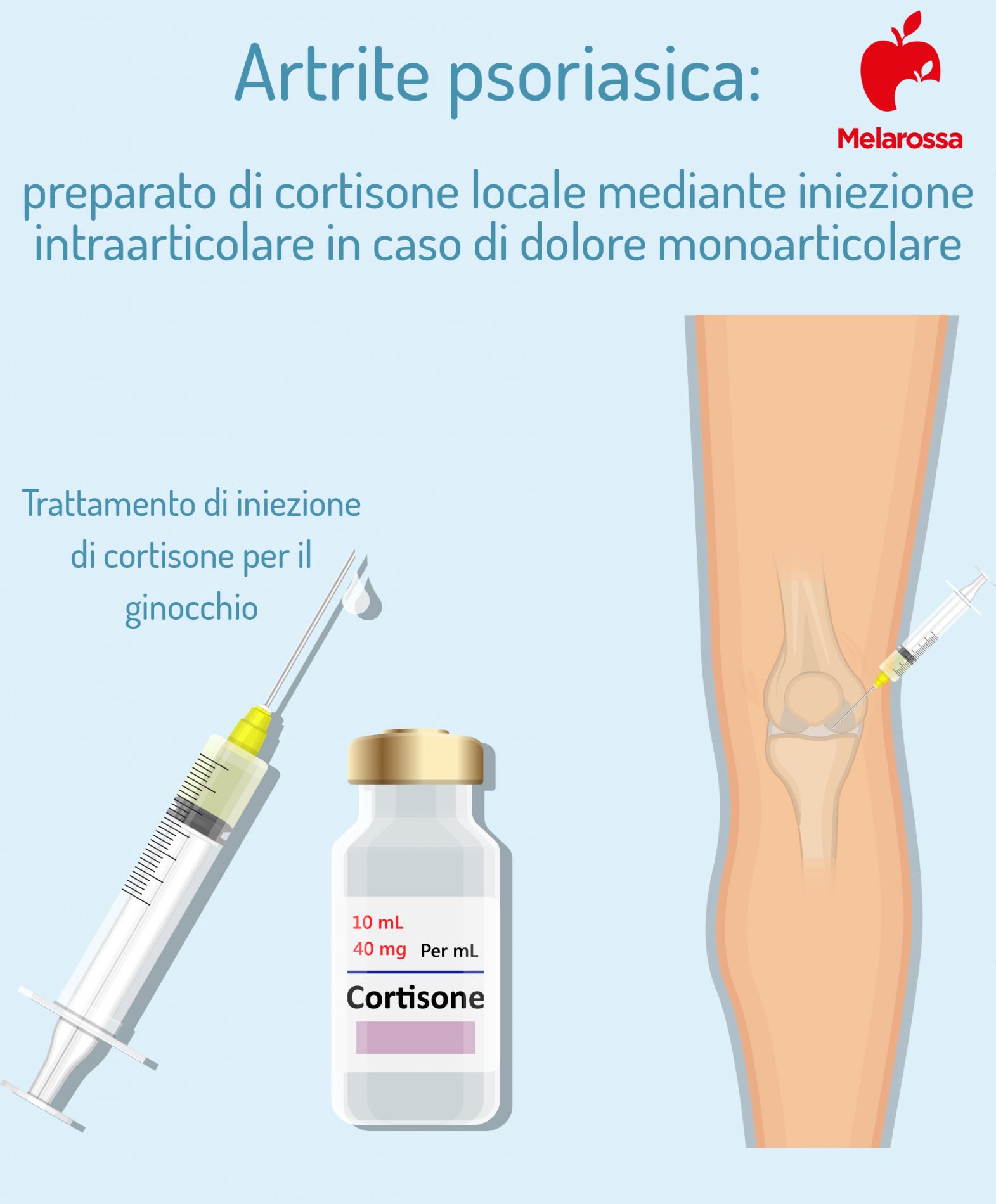 Artrite psoriasica: cos’è, cause, sintomi, diagnosi e cure 4 artrite psoriasica: cure