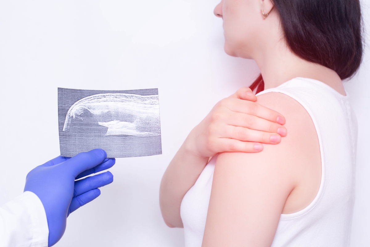 Artrite psoriasica: cos’è, cause, sintomi, diagnosi e cure 3 artrite psoriasica