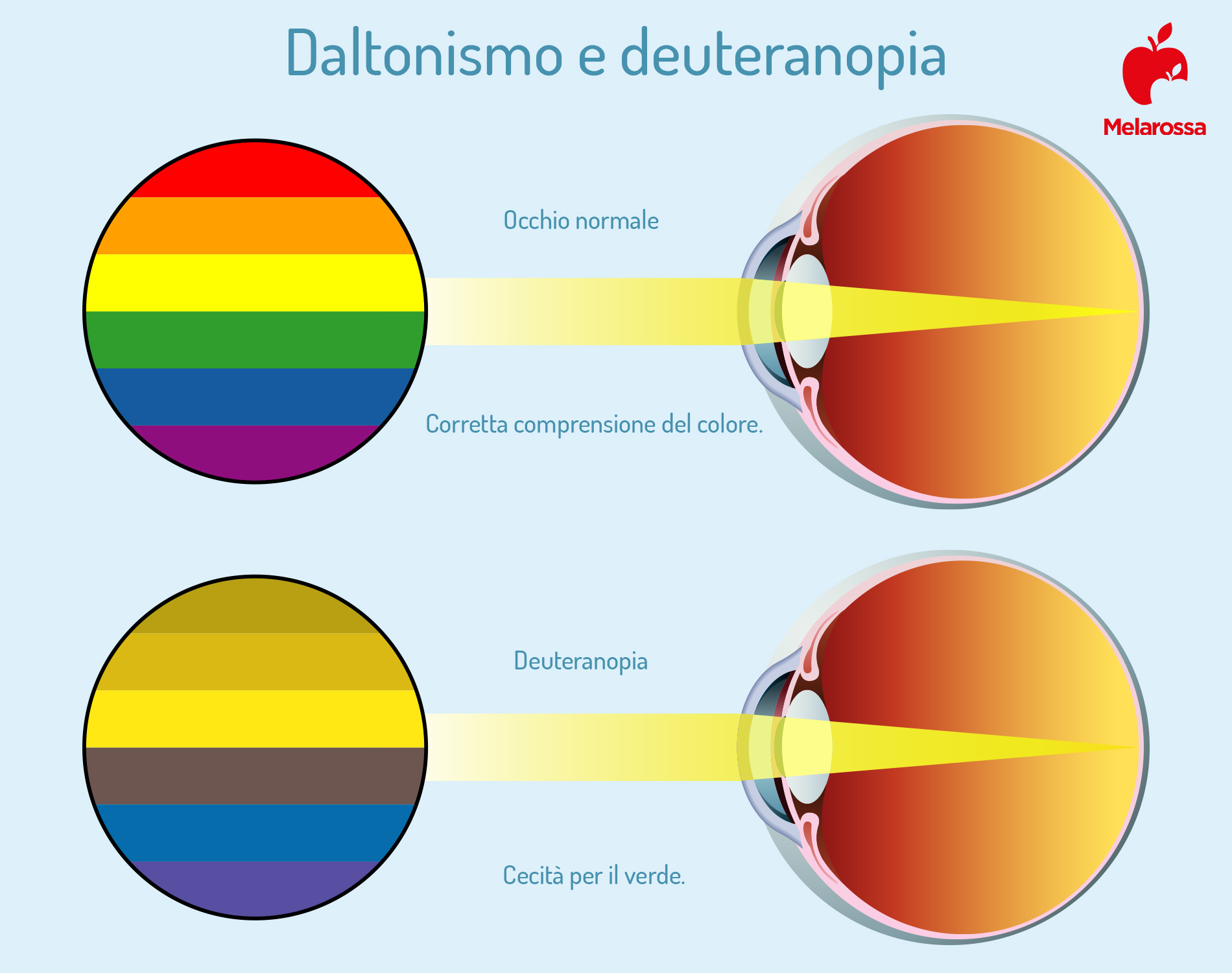 Daltonismo: cos’è, le diverse forme, cause, diagnosi e trattamento 2 daltonismo e deuteranopia
