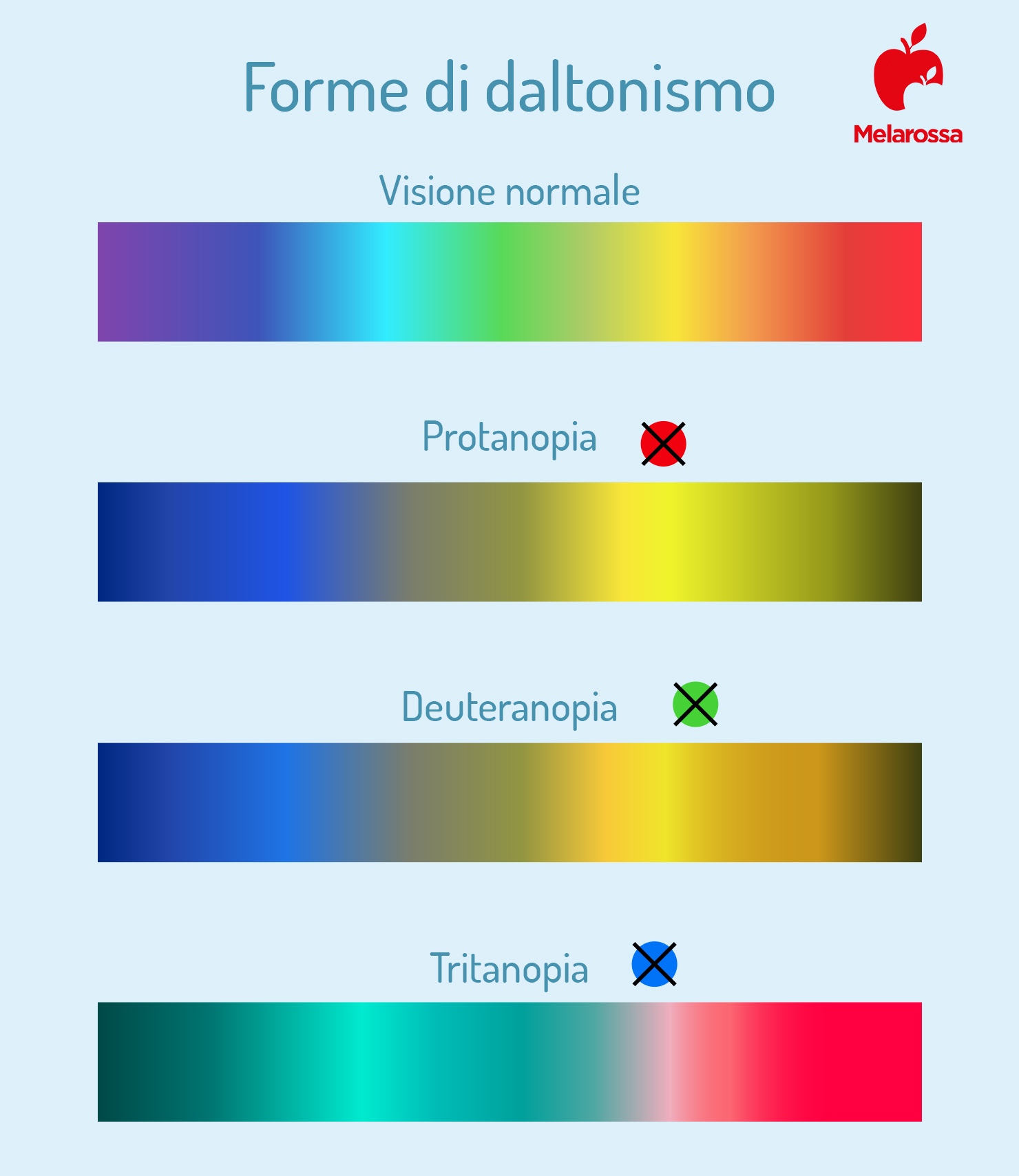 Daltonismo: cos’è, le diverse forme, cause, diagnosi e trattamento 3 forme di daltonismo