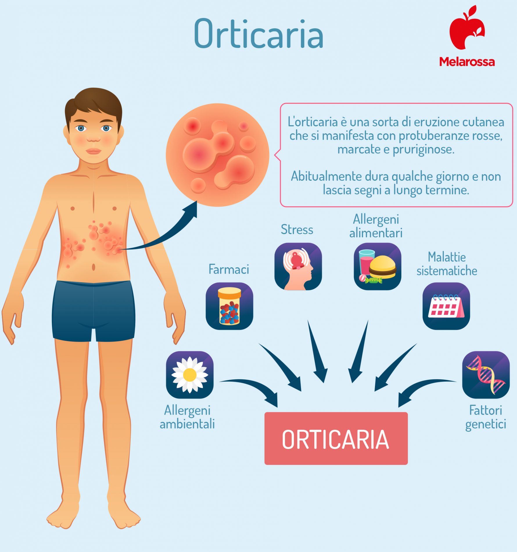 Orticaria: cos’è, cause, sintomi e tipologie 1 orticaria: cause