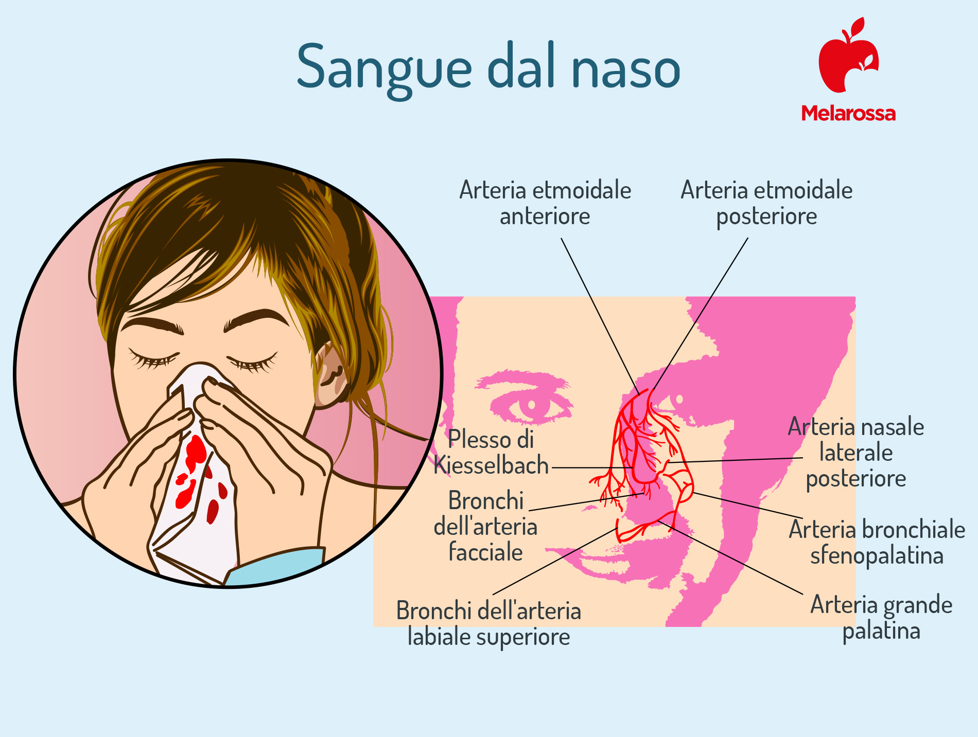 Sangue dal naso o epistassi: che cos’è, cause, sintomi, cure e trattamenti 2 sangue dal naso o epistassi: cos'è