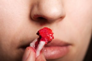 Sangue dal naso o epistassi: che cos&rsquo;&egrave;, cause, sintomi, cure e trattamenti