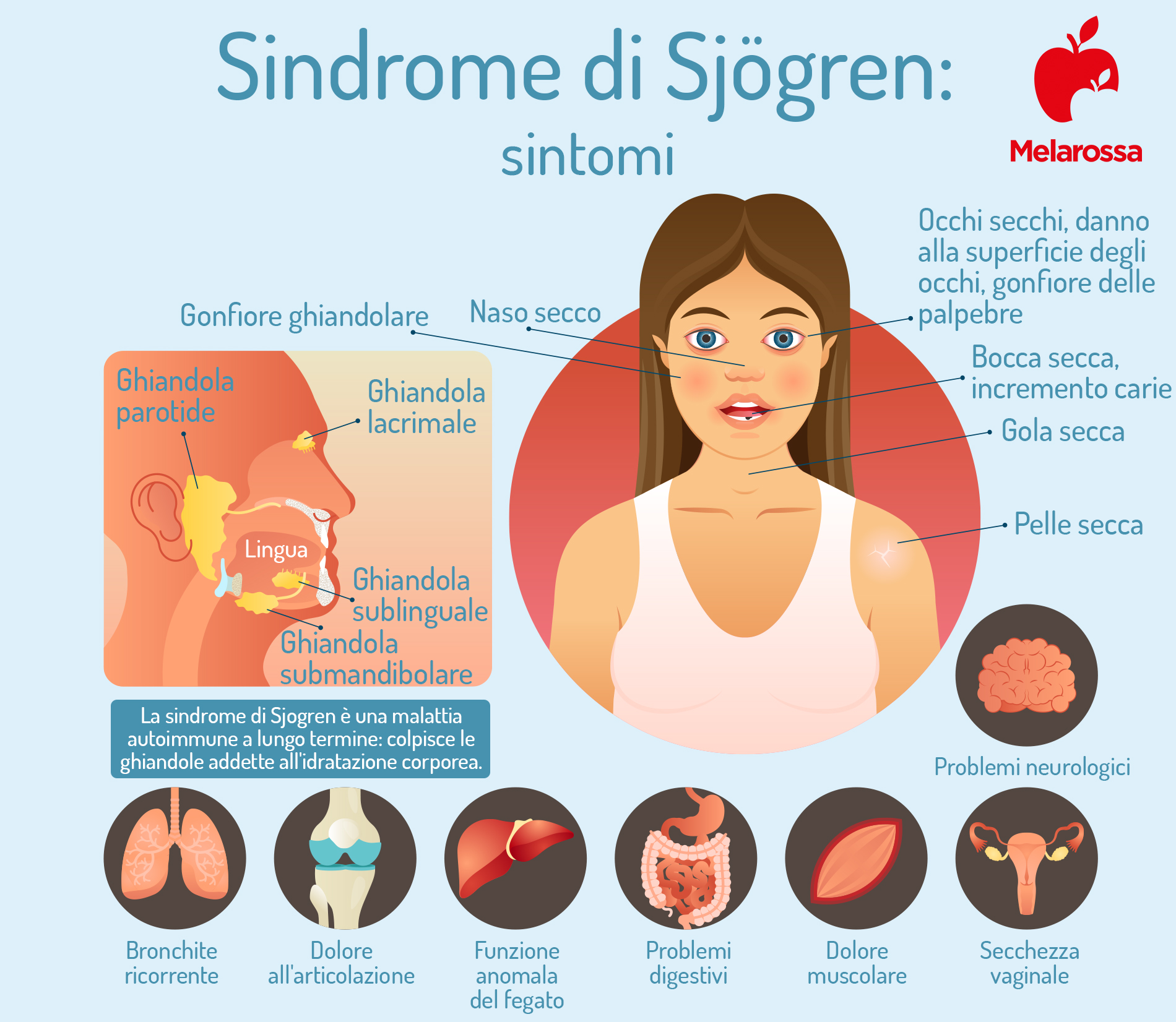 Sindrome di Sjögren: cos'è, cause, sintomi, fattori di rischio, diagnosi e terapia 2 sindrome di Sjögren: sintomi