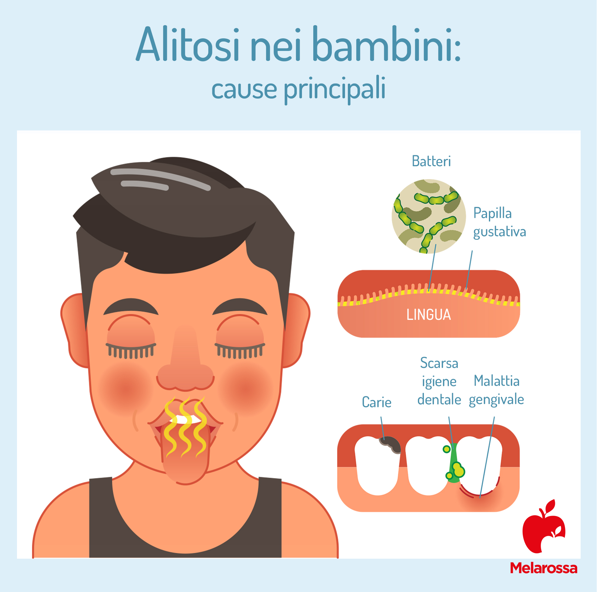Alitosi: cos’è, possibili cause, sintomi, tipi, cosa fare e rimedi 7 alitosi nei bambini: cause principali