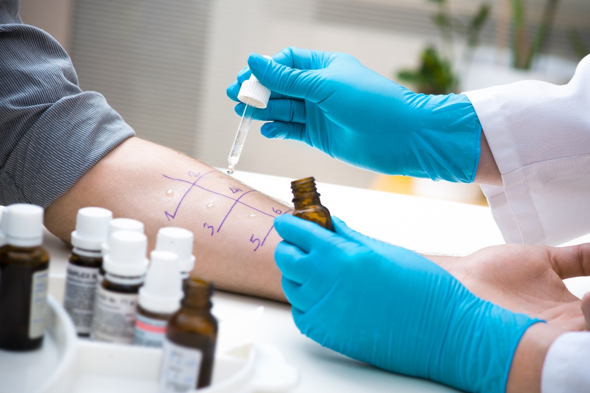 Allergia al nichel: cos'è, sintomi, diagnosi, cibi da evitare, cure e esempio di menù 7 allergia al nichel: test da fare