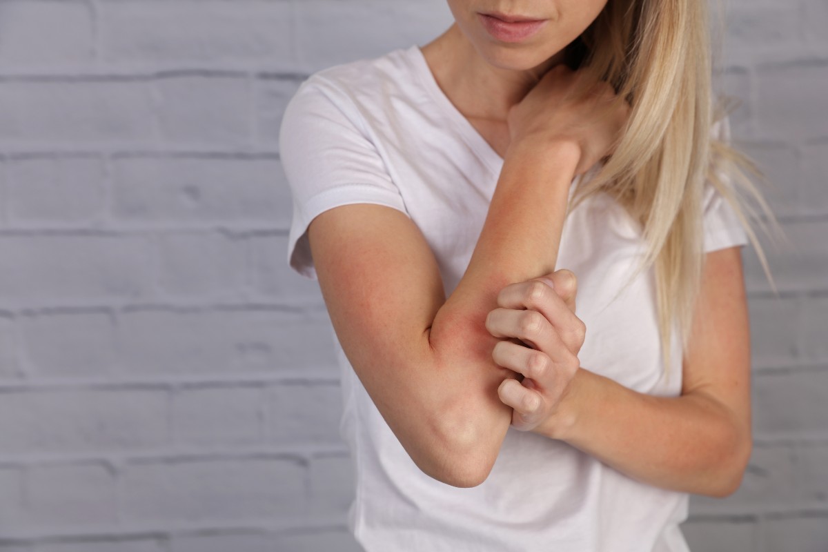 Allergia al nichel: cos'è, sintomi, diagnosi, cibi da evitare, cure e esempio di menù 6 allergia al nichel: sintomi