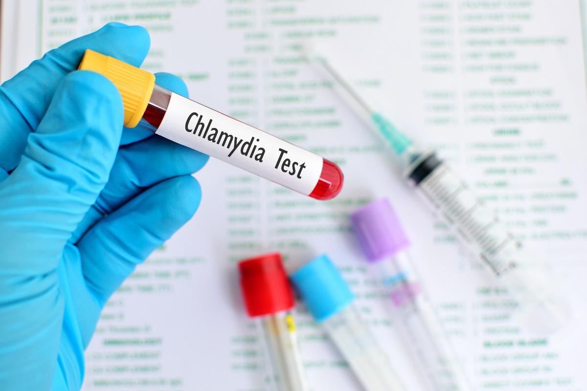 Clamidia: che cos’è, come si trasmette, sintomi cure e prevenzione 6 clamidia: diagnosi