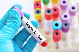 Legionella: cos&rsquo;&egrave;, caratteristiche, contagio, sintomi, cure e prevenzione