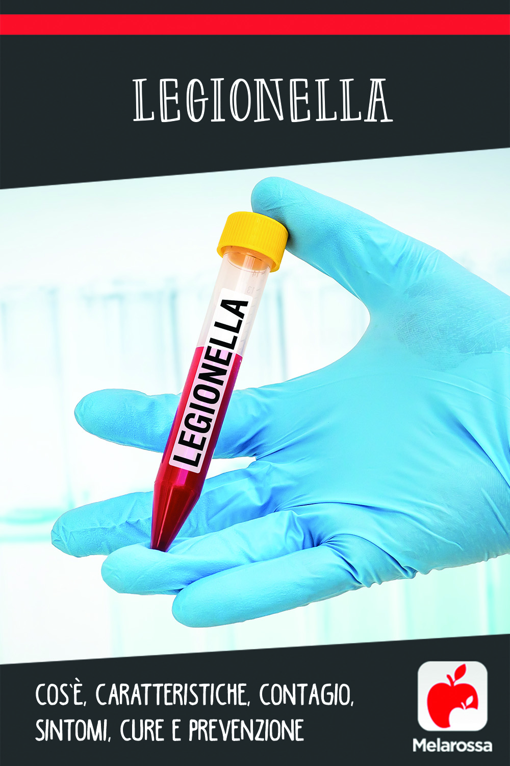 Legionella: cos’è, caratteristiche, contagio, sintomi, cure e prevenzione 7 legionella: c'sè, cause, sintomi e cure