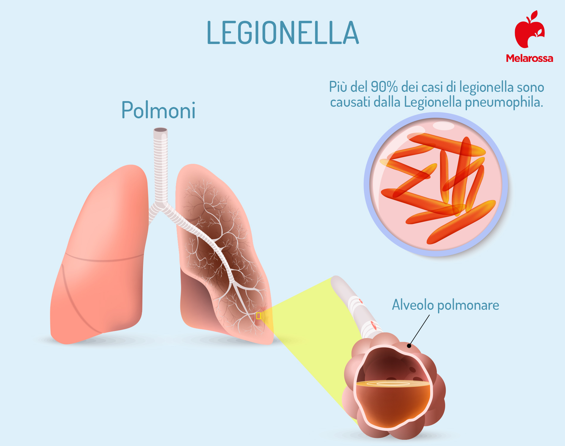 Legionella: cos’è, caratteristiche, contagio, sintomi, cure e prevenzione 1 legionella: cos'è