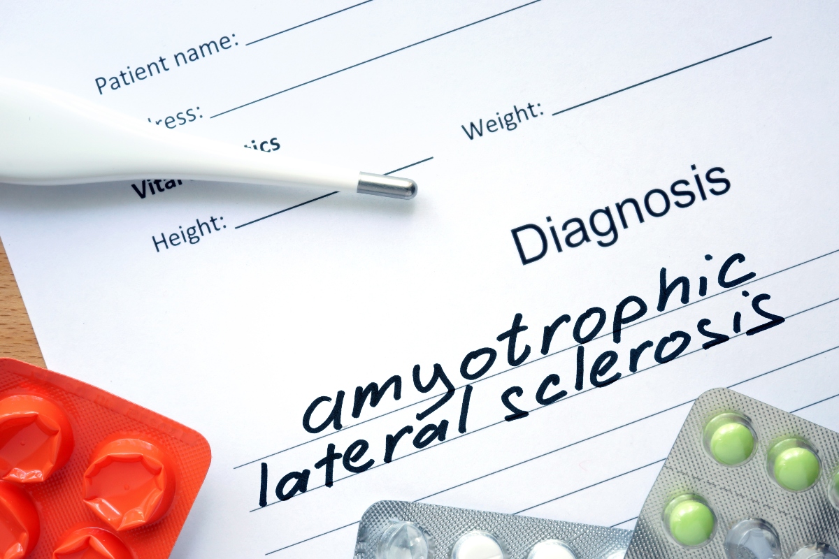 SLA o Sclerosi Laterale Amiotrofica : cos’è, chi colpisce, sintomi, cause, diagnosi, terapie disponibili e assistenza malati 6 SLA: diagnosi