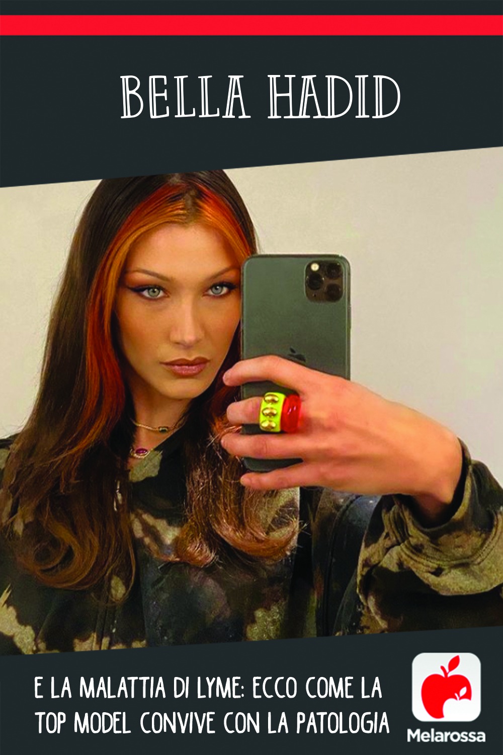Bella Hadid e la malattia di Lyme: ecco come la top model convive con la patologia 2 bella hadid malattia di lyme