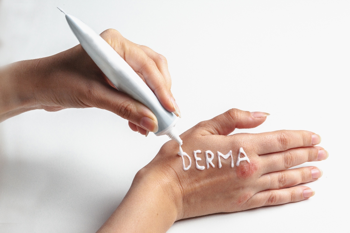Dermatite da contatto: cos’è, come si classifica, cause, sintomi, cure, rimedi naturali e come prevenire 5 come curare la dermatite da contatto