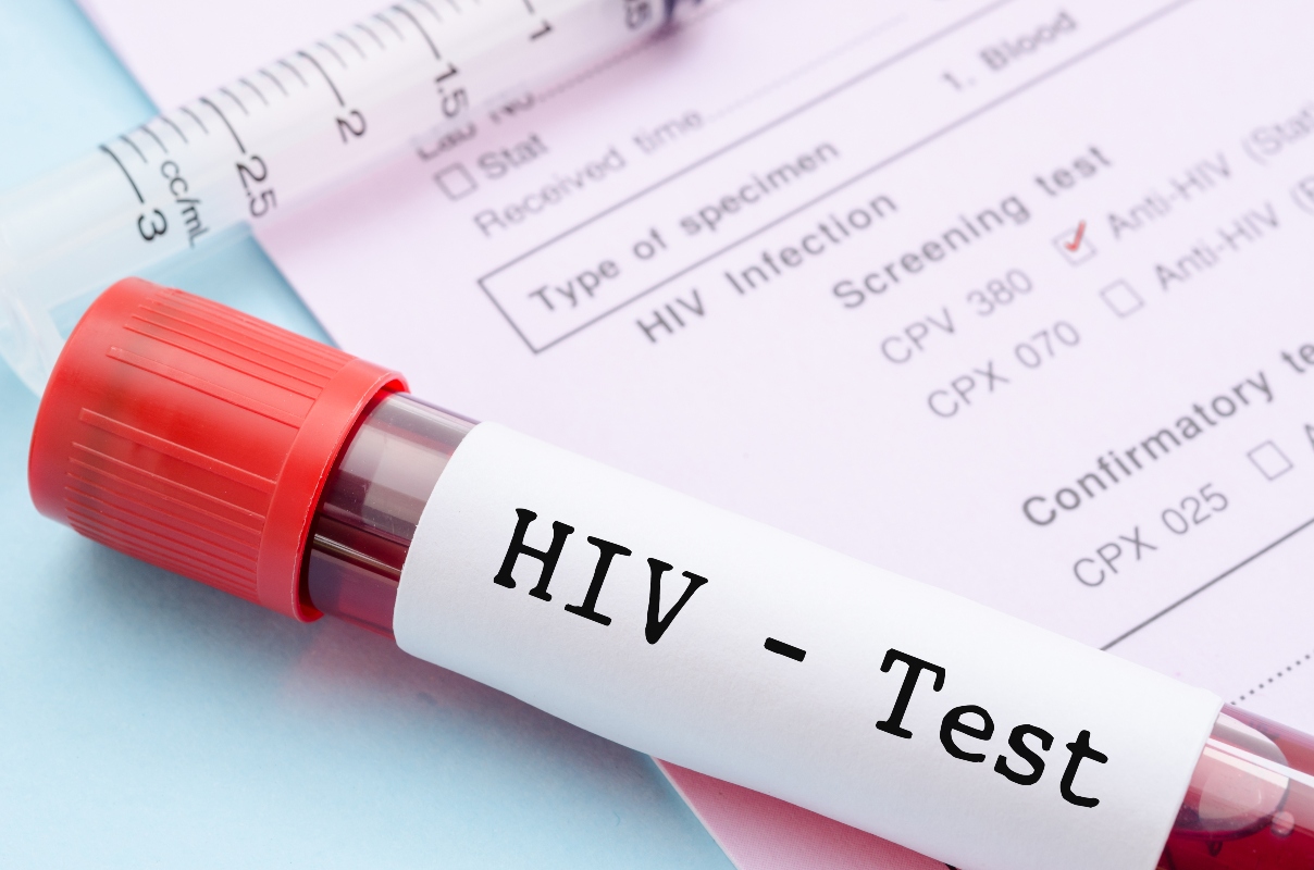 AIDS e HIV: che cosa sono, contagio e cause, sintomi, diagnosi, cura, prevenzione 5 diagnosi AIDS: test HIV