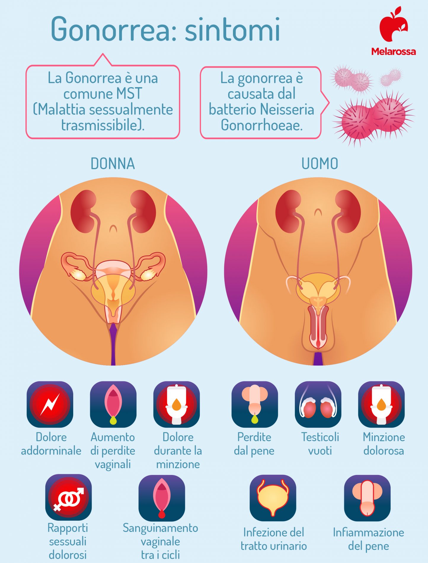Gonorrea: cos’è, cause, come si trasmette, sintomi, cure e come prevenire l’infezione 3 gonorrea sintomi uomo e donna