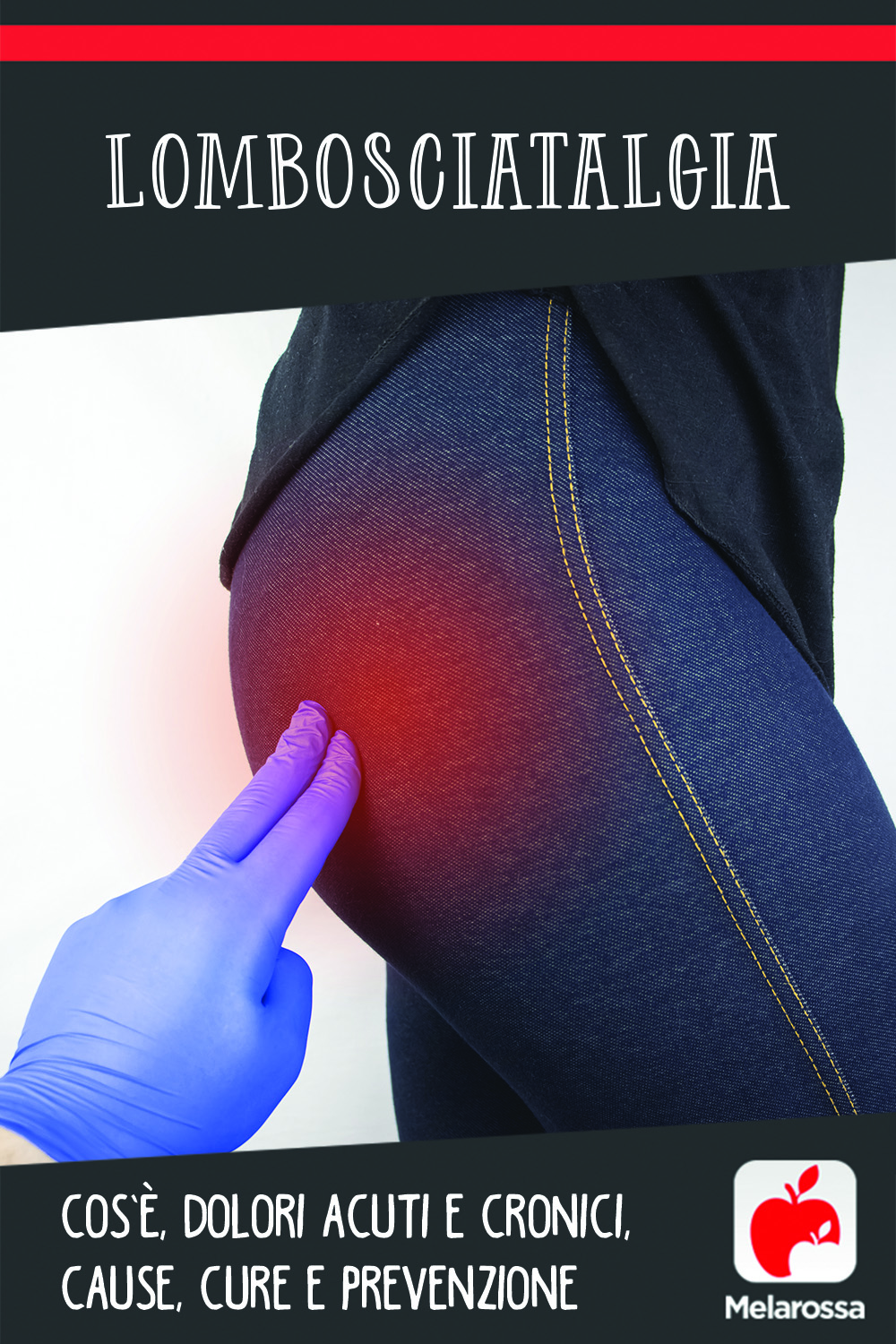 Lombosciatalgia: cos’è, dolori acuti e cronici, cause, cure e prevenzione 13 lombosciatalgia: cos'è cause, sintomi e cure