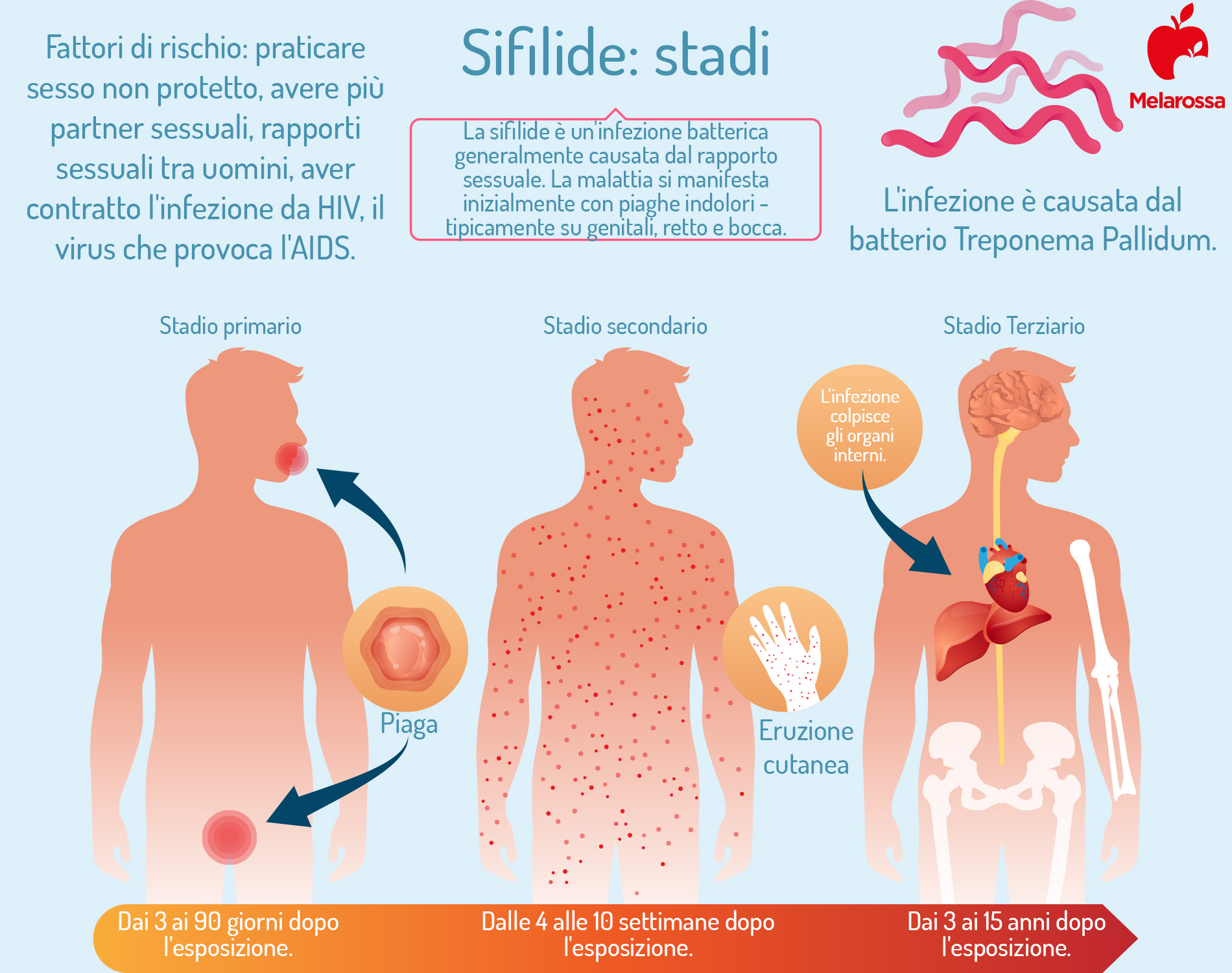Sifilide: cos’è, come si trasmette, sintomi e trattamento 3 sifilide: stadi