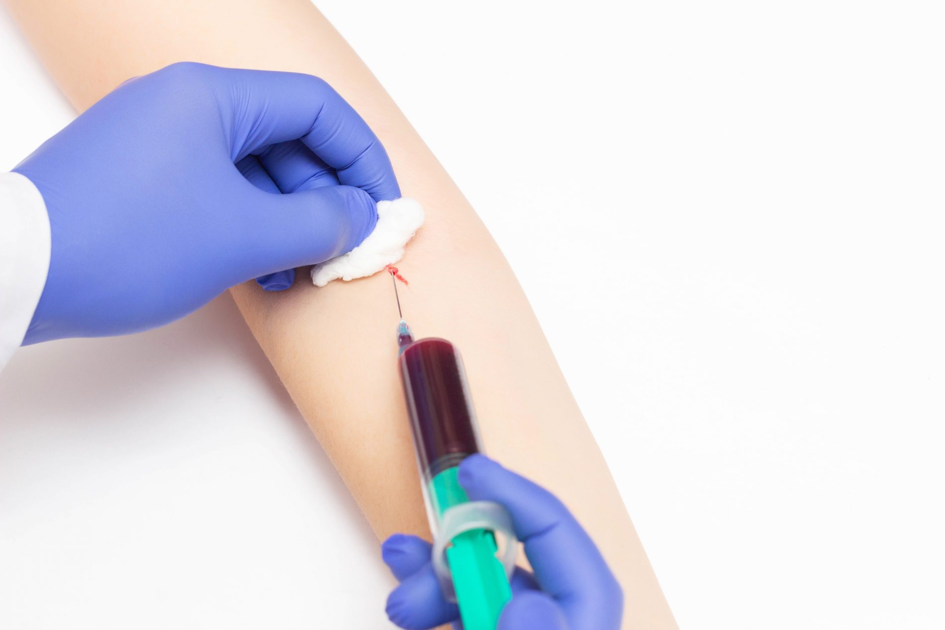 TSH (tireotropina): cos’è, come funziona l’esame, valori normali e cosa fare quando è alto o basso 2 TSH: analisi del sangue