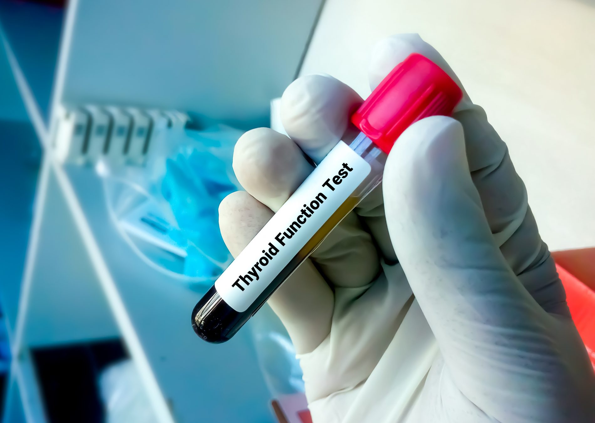 TSH (tireotropina): cos’è, come funziona l’esame, valori normali e cosa fare quando è alto o basso 6 TSH: test