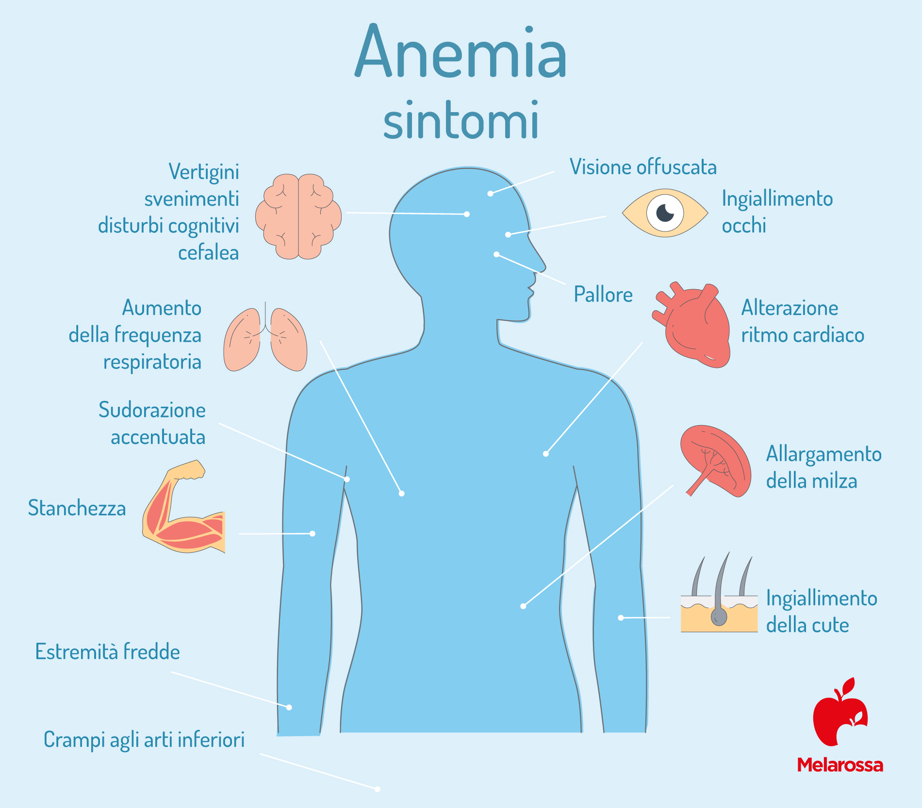 VES: cos’è, perché misurarla, valori normali e alti, quando preoccuparsi, patologie associate 4 VES: cause dell'anemia