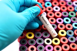 Epatite C: cos&rsquo;&egrave;, cause e sintomi, contagio, fattori di rischio, diagnosi, cure e prevenzione