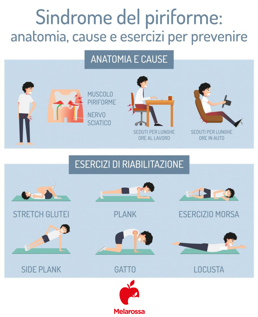Mal di schiena: cos'è, tipi, sintomi, cause, quando preoccuparsi, trattamenti e prevenzione 10 sindrome del piriforme: mal di schiena
