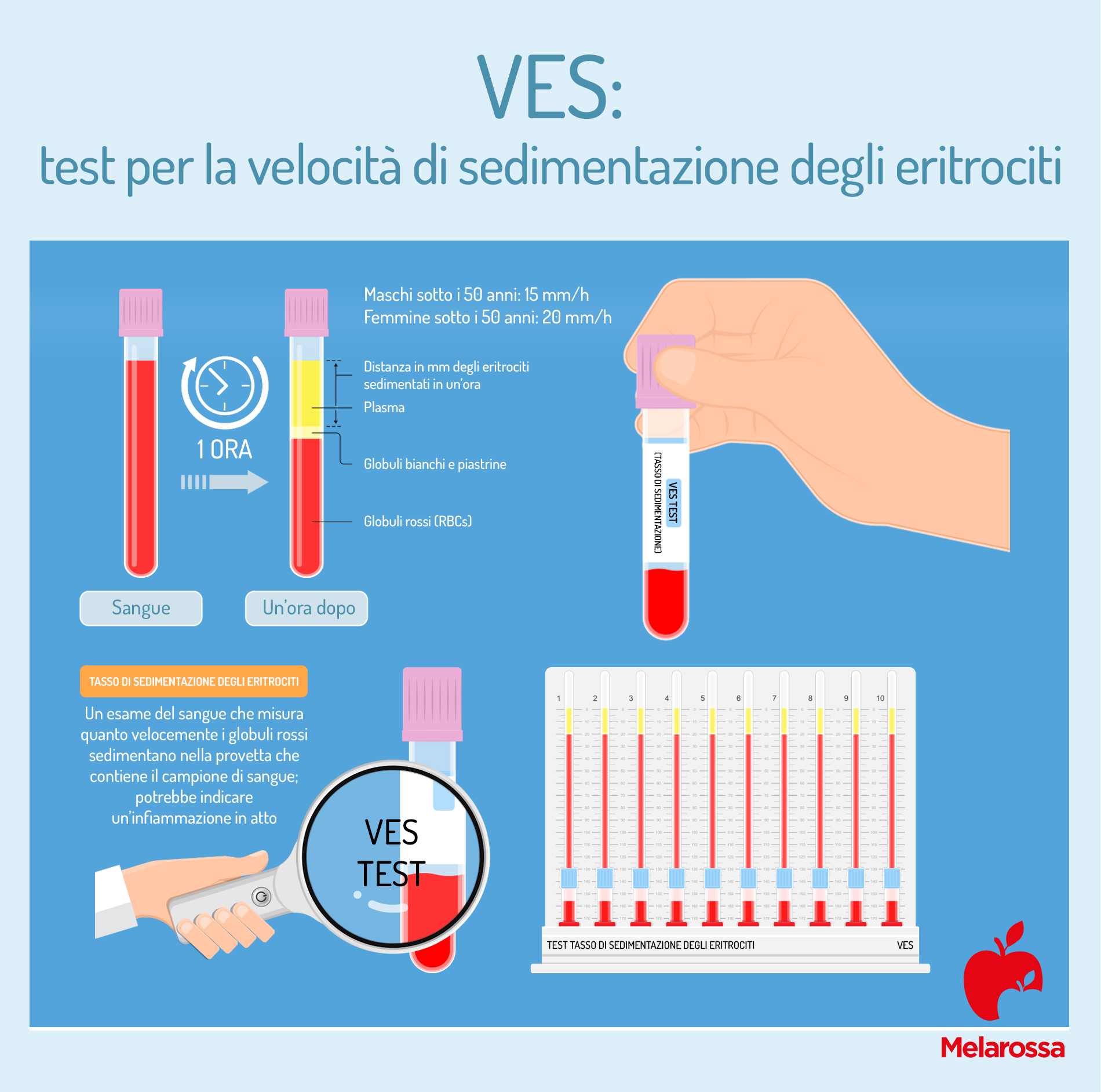 VES: cos’è, perché misurarla, valori normali e alti, quando preoccuparsi, patologie associate 1 VES: come funziona