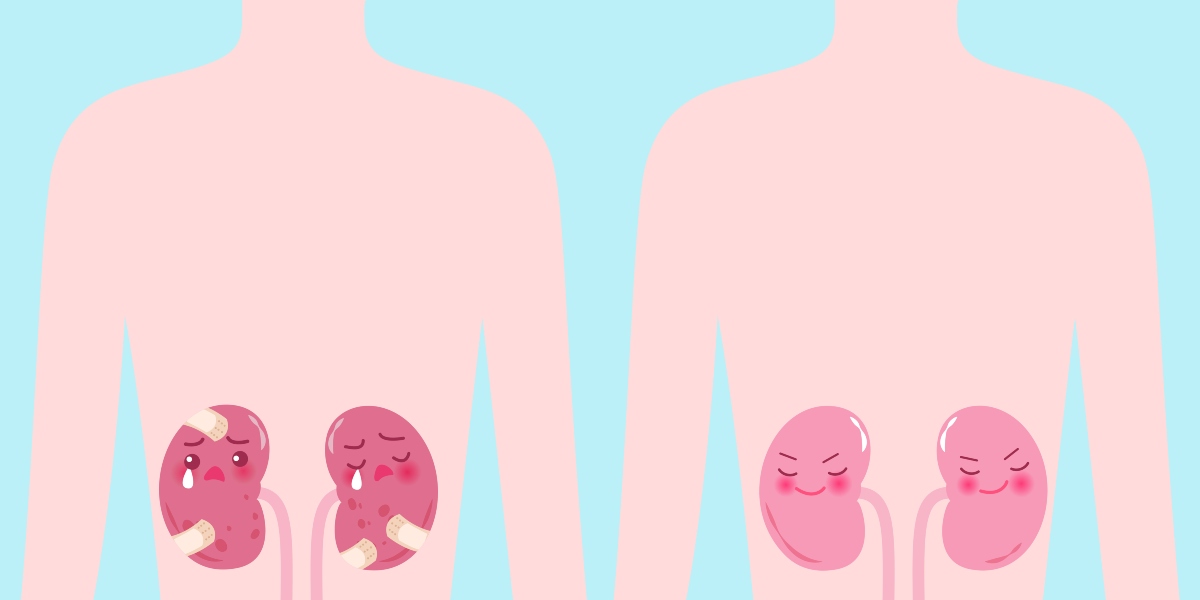 Azotemia: cos’è, perché e come si misura, risultati, valori alti e bassi, quando preoccuparsi, cure e diete 5 Azotemia: valori bassi