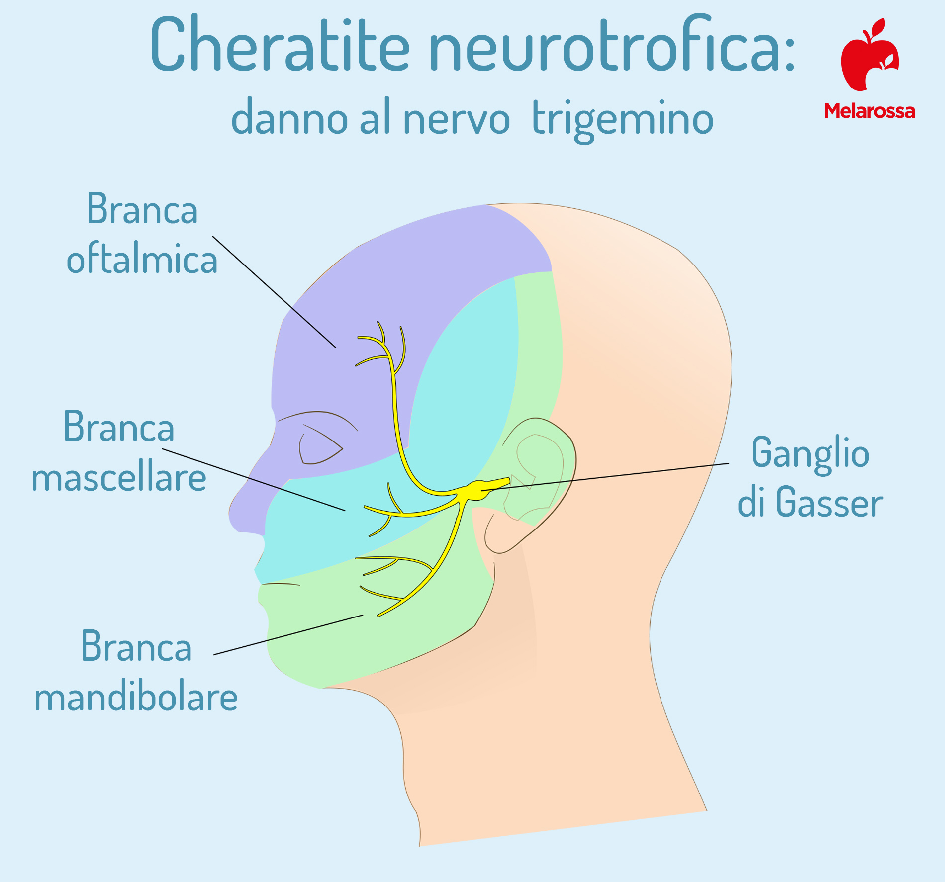 Cornea: cos’è, anatomia, funzioni, principali patologie, trattamenti e cure 12 cornea e cheratite