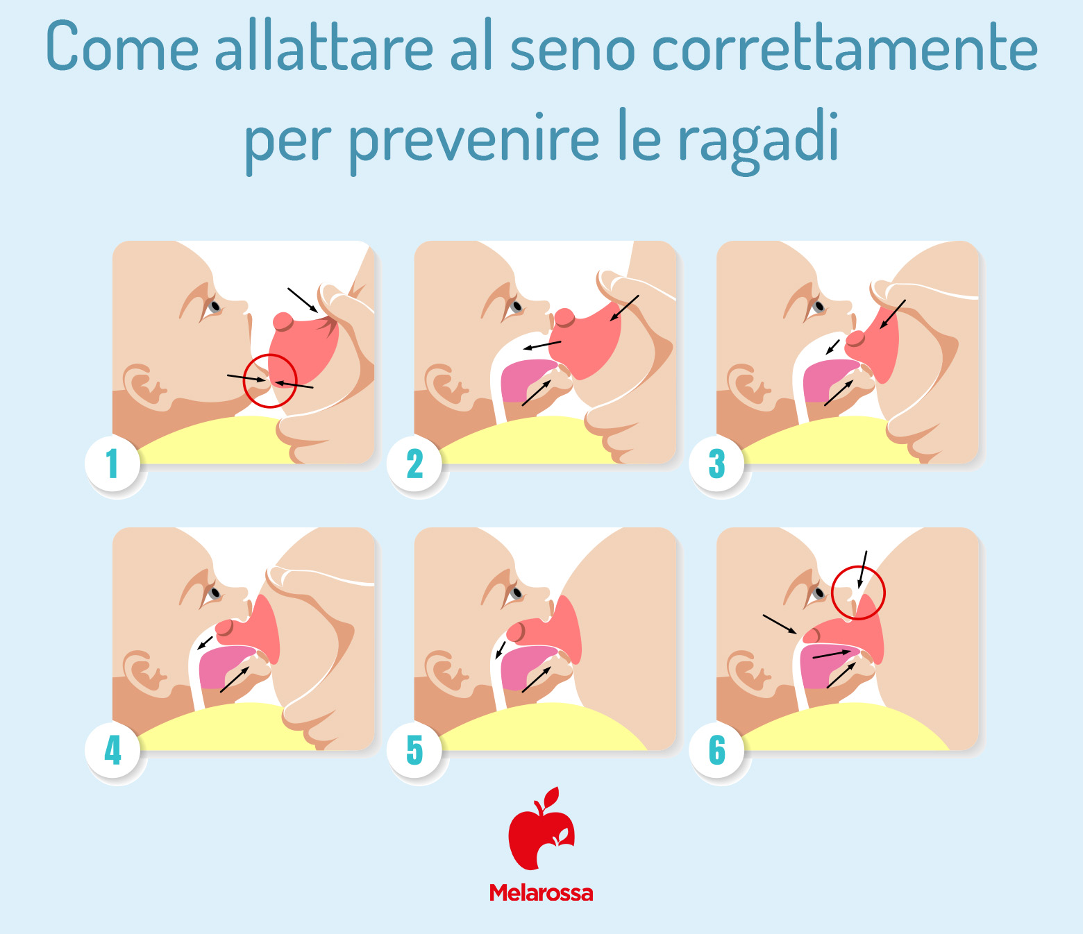 Ragadi al seno: cosa sono, cause e sintomi, come allattare, cure e prevenzione 4 Ragadi al seno: come prevenirle allattando correttamente