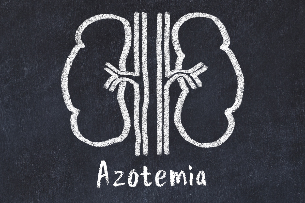 Azotemia: cos’è, perché e come si misura, risultati, valori alti e bassi, quando preoccuparsi, cure e diete 2 tipi di azotemia